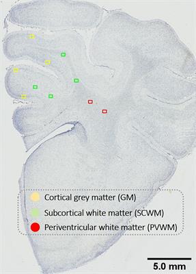 The synergistic effects of mechanical ventilation and intrauterine inflammation on cerebral inflammation in preterm fetal sheep